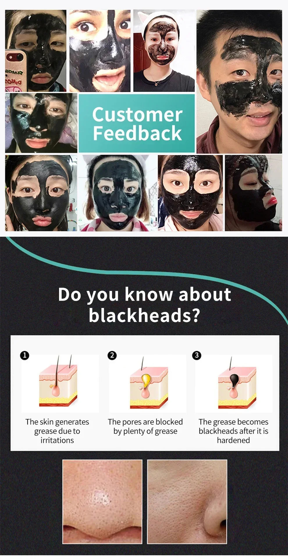 LANBENA Remove Blackhead Mask Shrinking Pore Deep Cleaning Mask Improve Rough Skin Acne Treatment Skin Brighteing Care Beauty